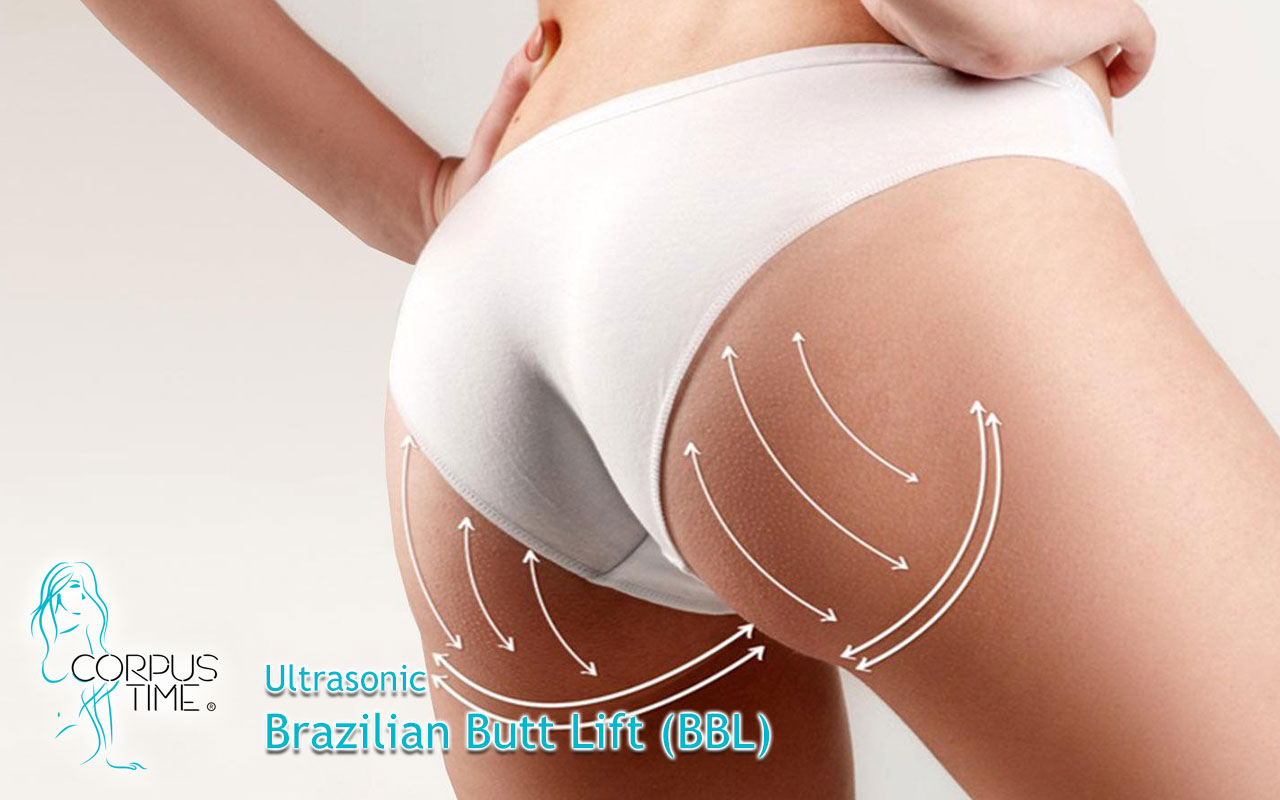 What Is Brazilian Butt Lift (BBL)?