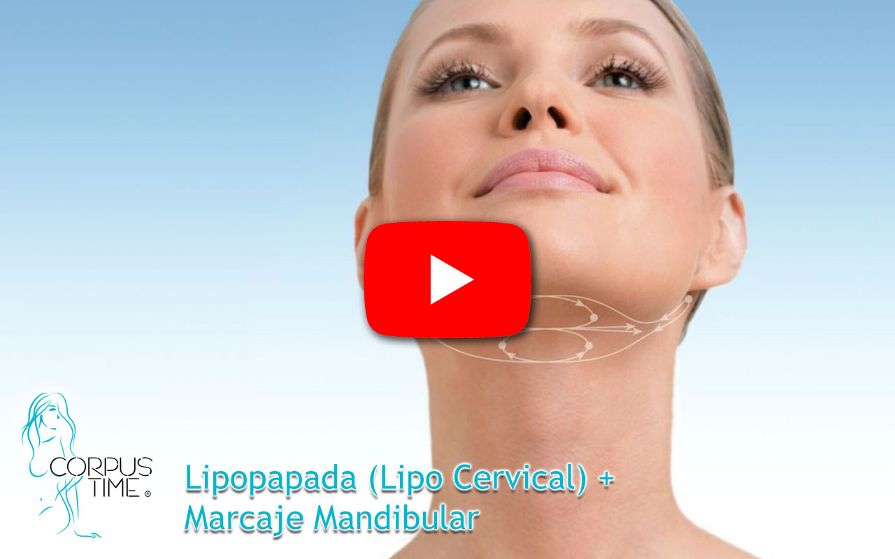 Lipopapada (Lipo Cervical) + Marcaje Mandibular